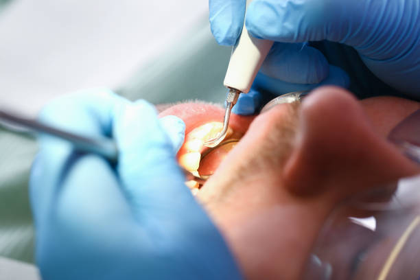 Best Pediatric Emergency Dentist in Monticello, UT