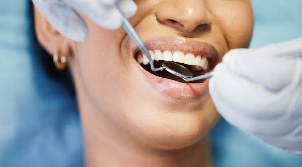 Best Emergency Dental Extractions in Monticello, UT
